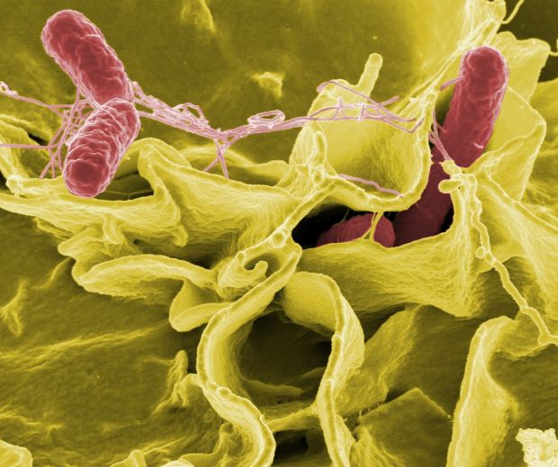 Salmonellen sind beim Menschen zunehmend resistent gegen Fluorchinolone. Salmonellen sind beim Menschen zunehmend resistent gegen Fluorchinolone.